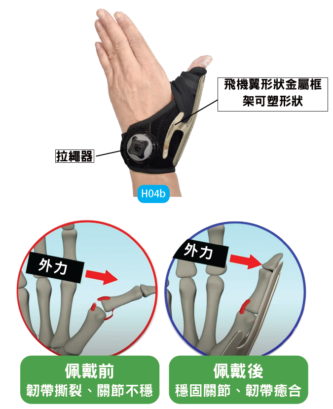 Thumb brace details